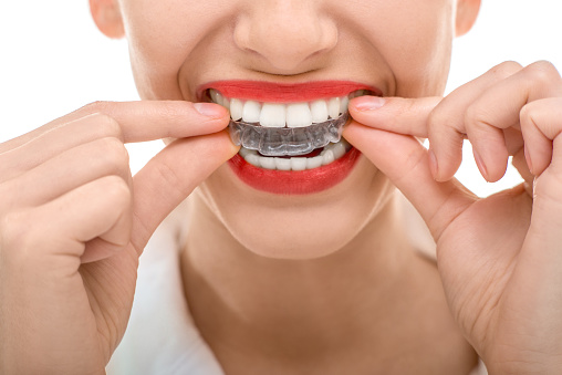 Invisalign® in Charles County, MD